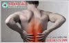 Phương pháp điều trị đau lưng cấp mạn tính